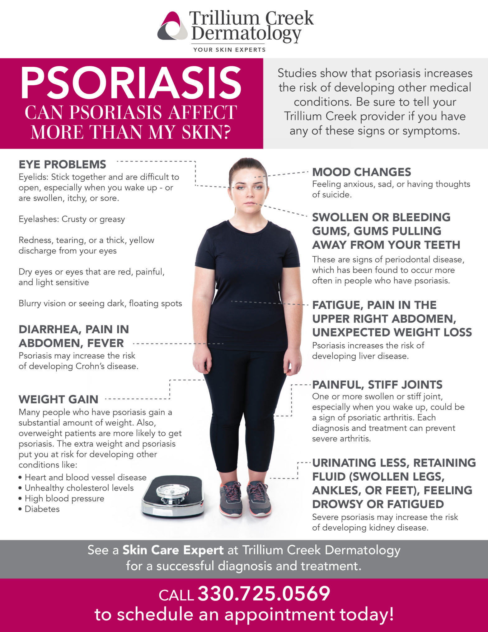 Psoriasis Treatment Near Me Psoriasis Causes Ohio